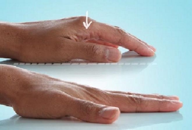 8 Effective Hand Strengthening Exercises You Can Do At Home